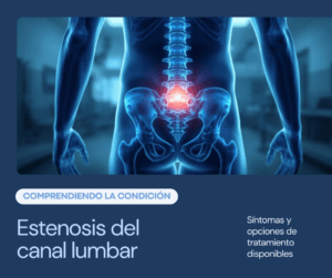 Estenose do Canal Lombar: Sintomas e Tratamento