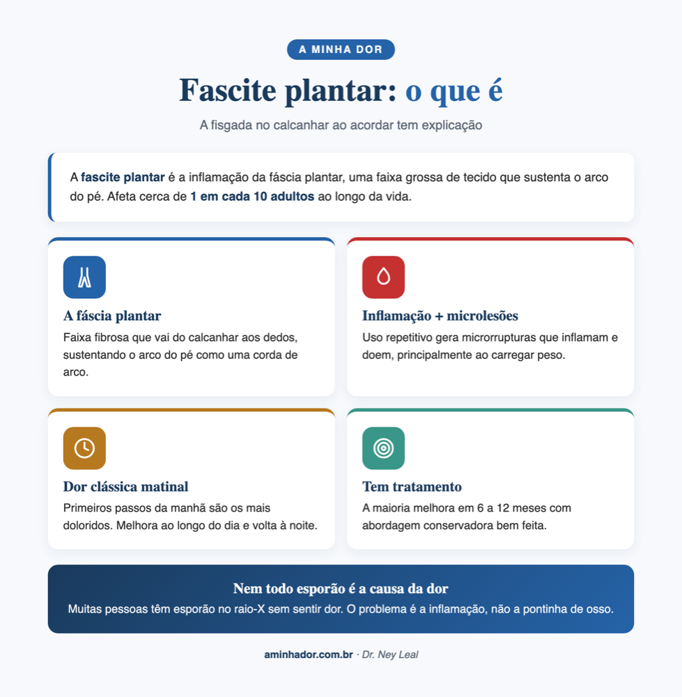 Fascite Plantar: Aquela Fisgada no Calcanhar ao Acordar