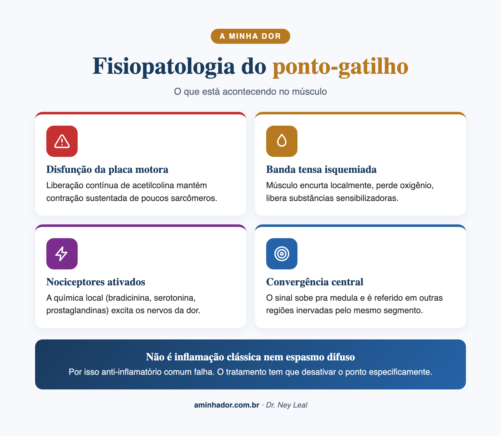 síndrome dolorosa miofascial: banda tensa e ponto-gatilho